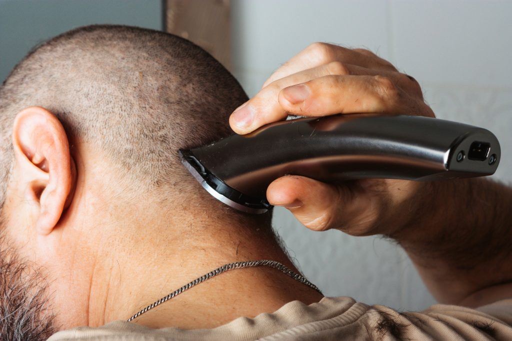 Injerto capilar sin rapar