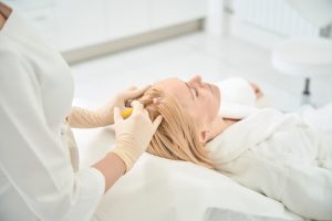 Injerto capilar en mujeres