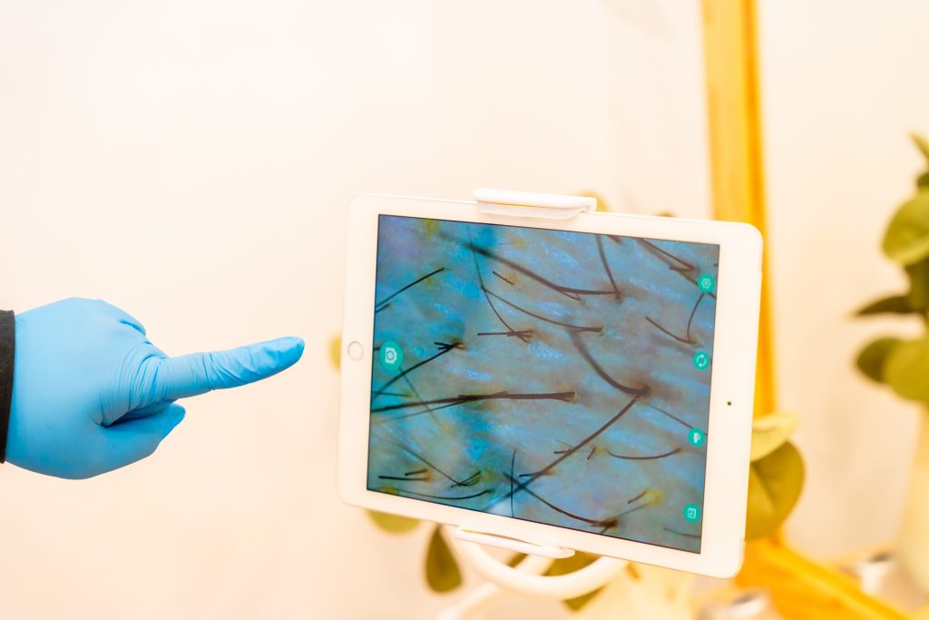 Cómo elegir una clínica capilar